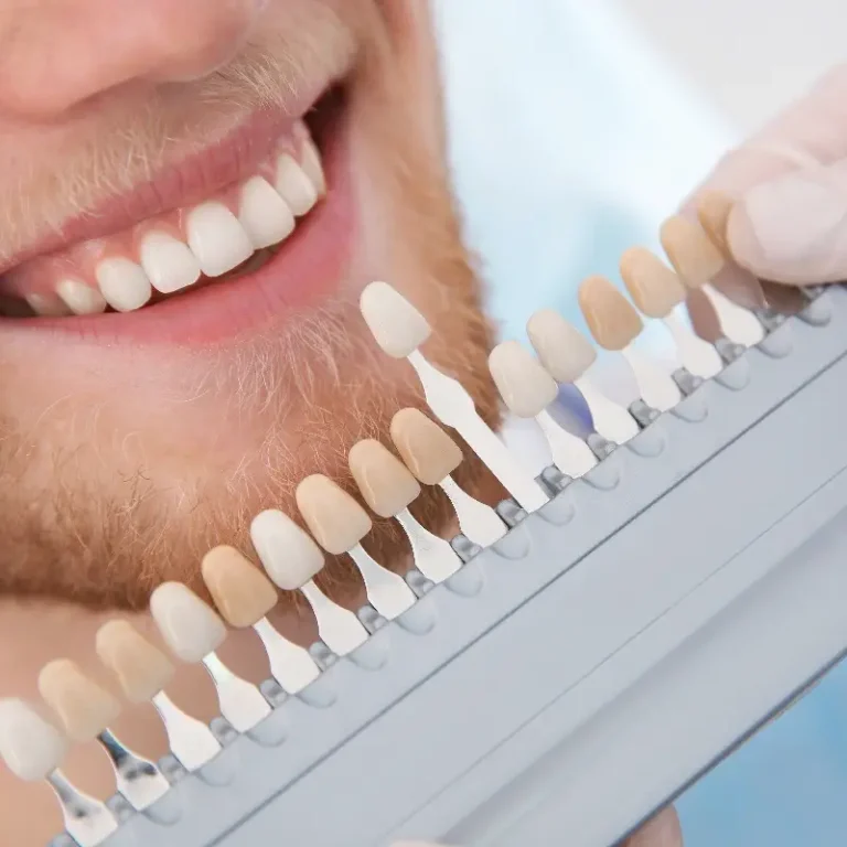 estetica-dental